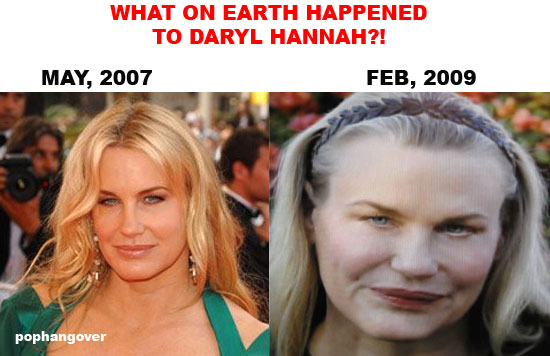 Some women choose to try plastic surgery - only to have it backfire on them like Daryl Hannah.  